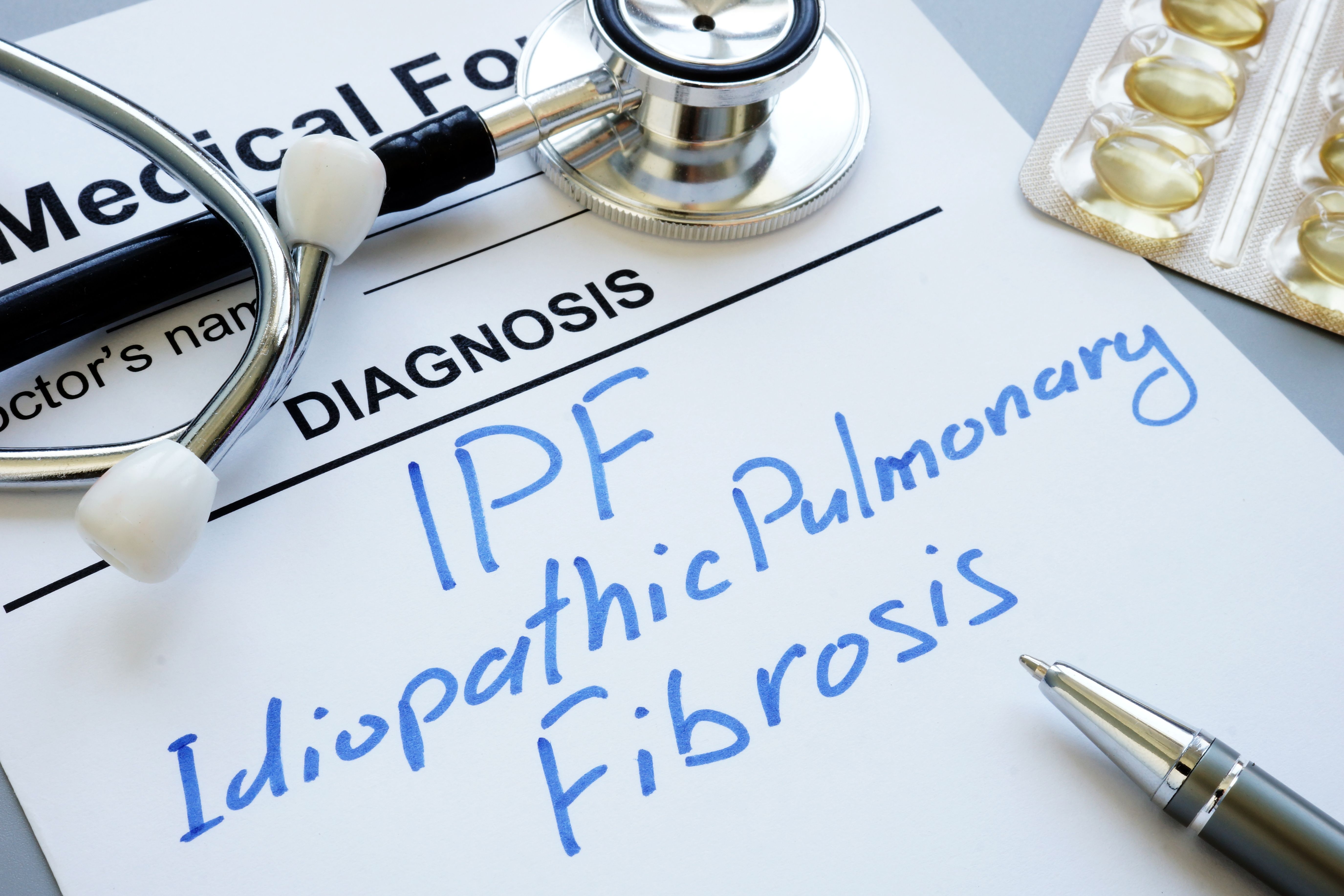 IPF diagnosis | Image credit: Vitalii Vodolazskyi - stock.adobe.com