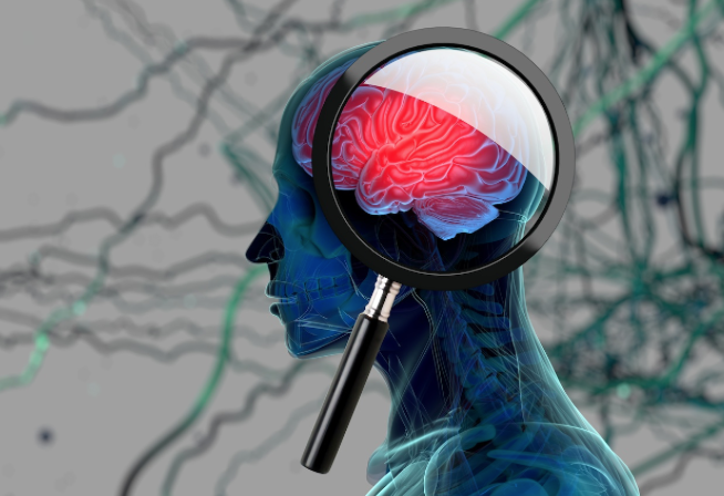brain_magnify