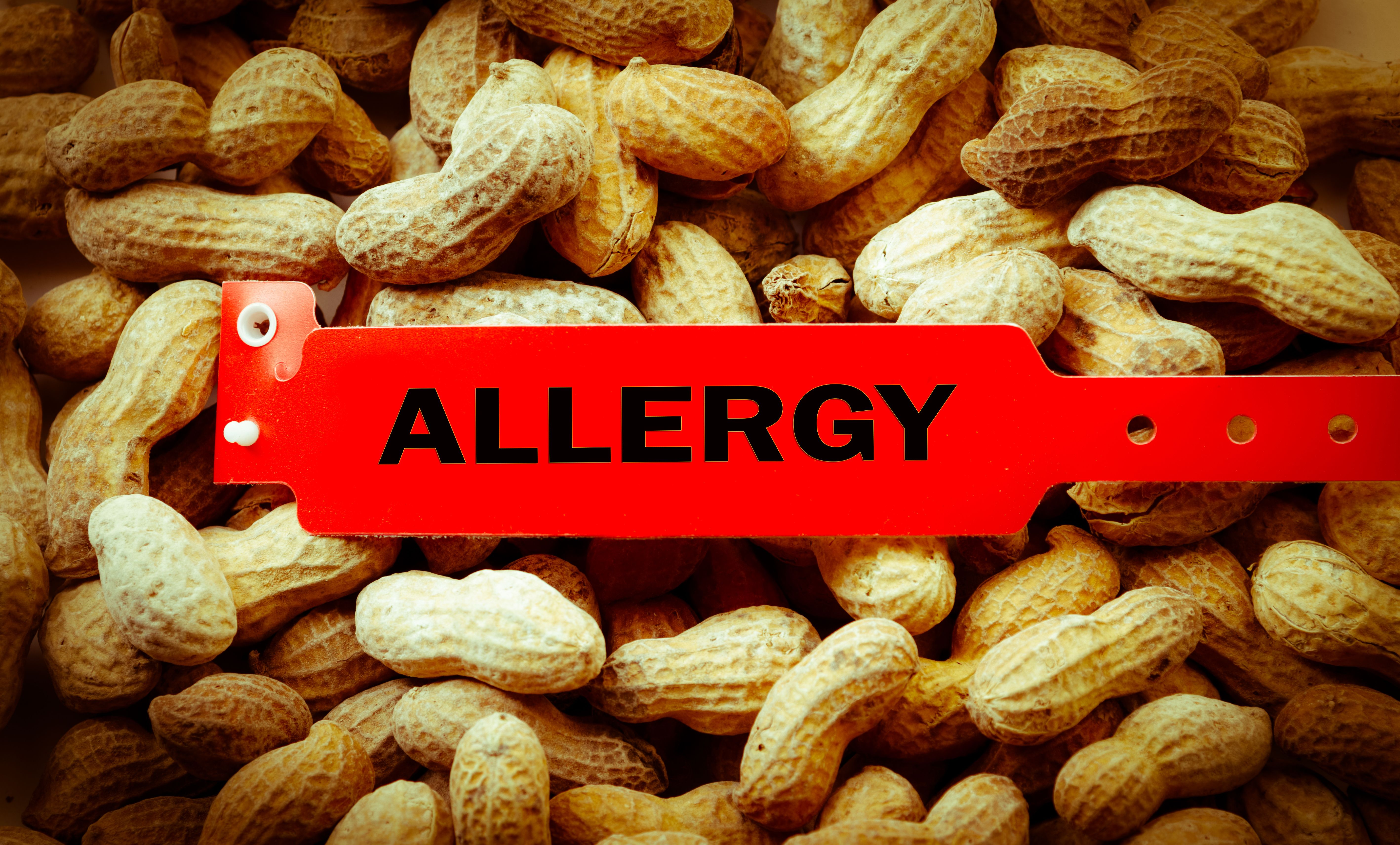 Peanut allergy. | Image Credit:  Angela Schmidt -  stock.adobe.com