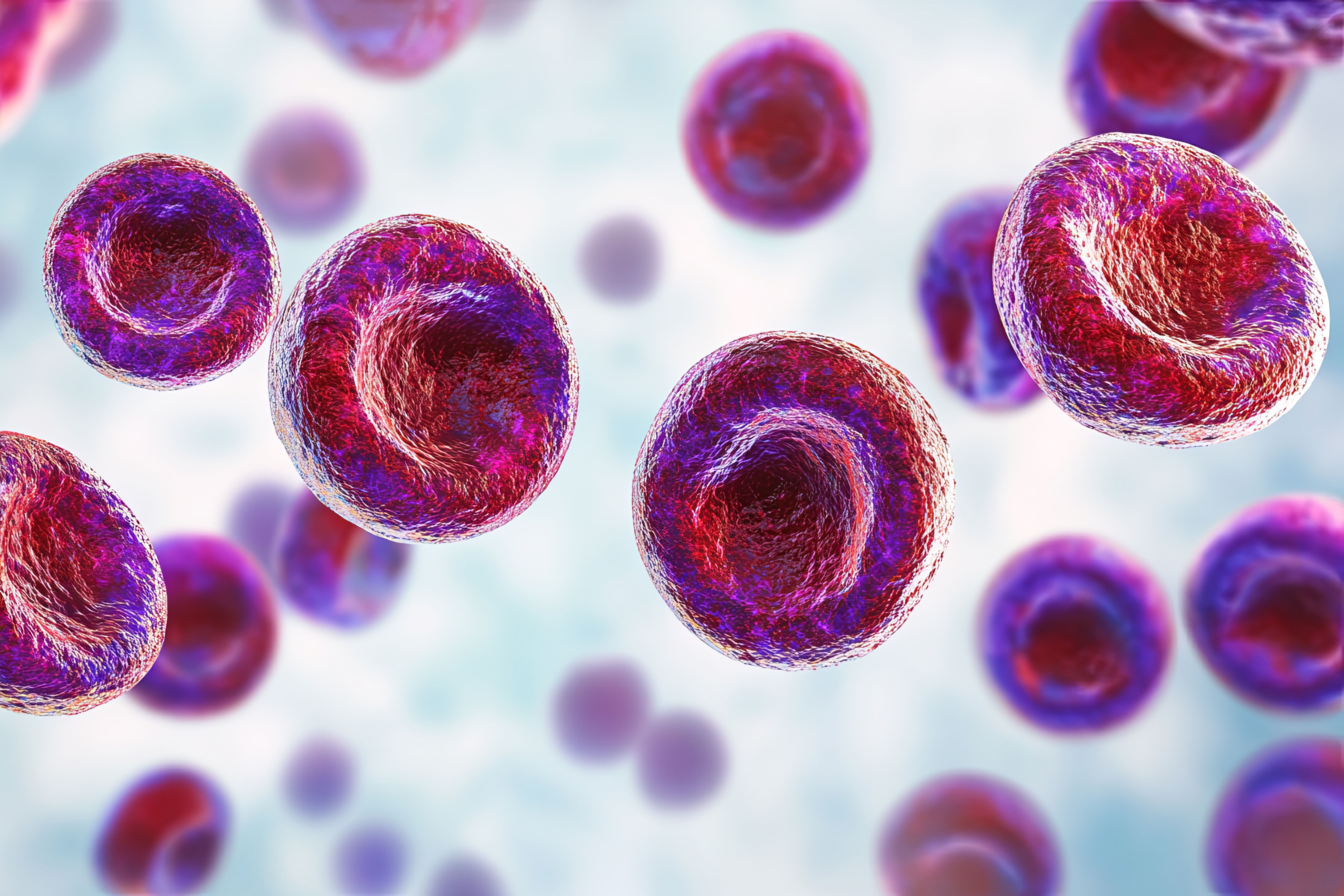 In a 100-patient clinical practice scenario, cost savings with zanubrutinib vs ibrutinib would amount to $4.7 million. | Image credit: sovova - stock.adobe.com